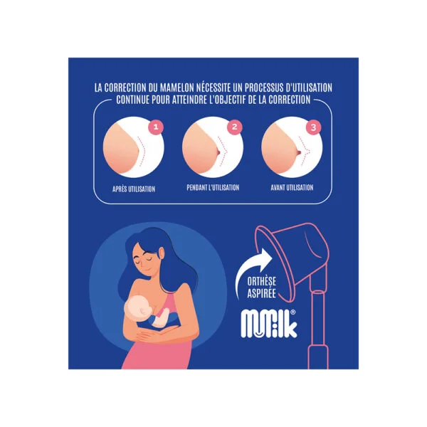 MuMilk Correcteur de Mameloner les mamelons